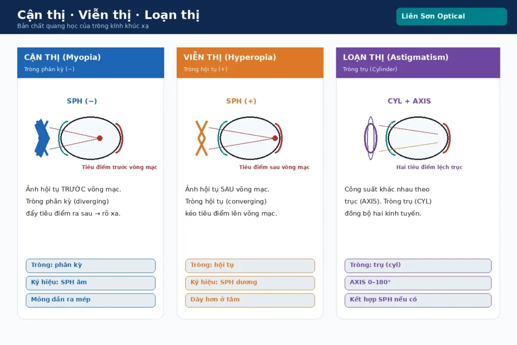 Sơ đồ cận thị viễn thị loạn thị — bản chất quang học tròng kính khúc xạ