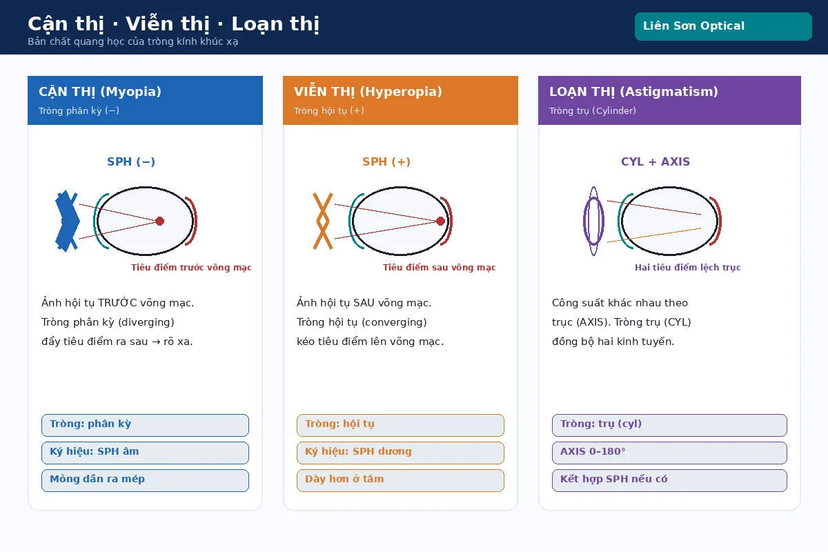 Sơ đồ cận thị viễn thị loạn thị — bản chất quang học tròng kính khúc xạ