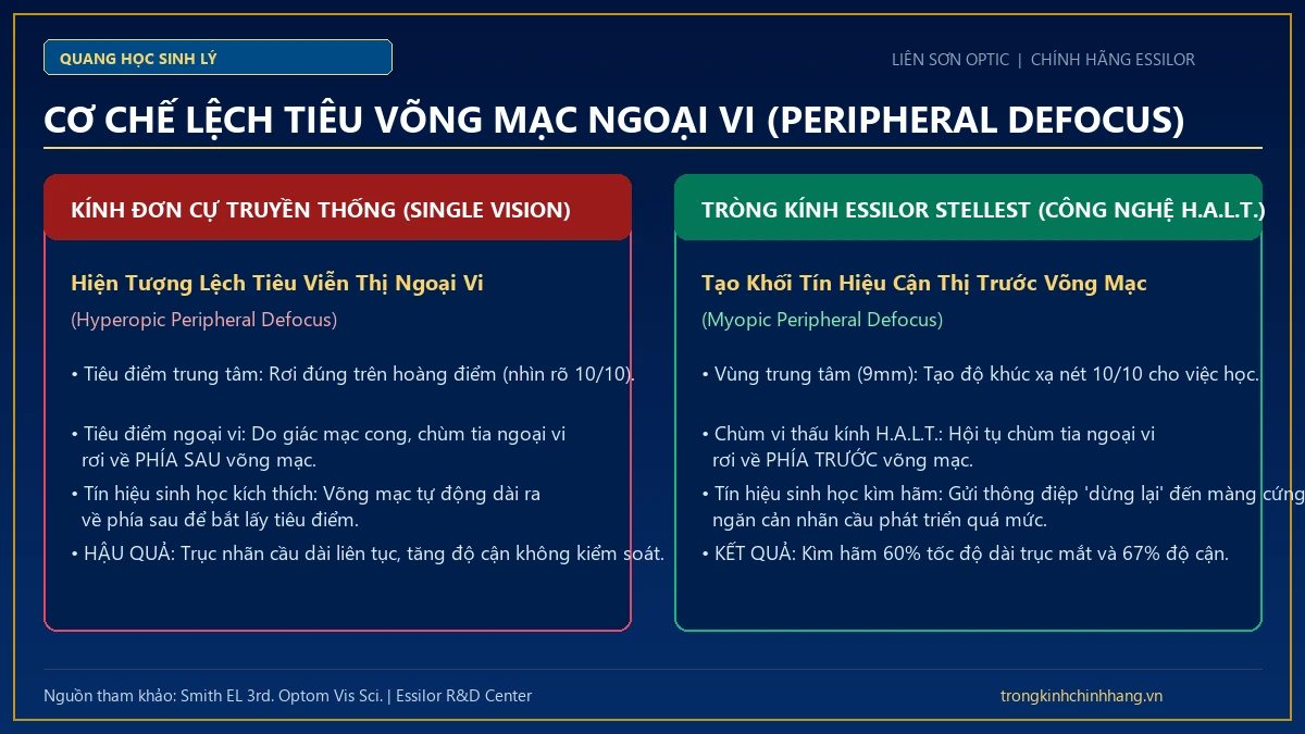 Nghịch lý quang học của kính đơn tròng truyền thống và hiện tượng lệch tiêu viễn thị ngoại vi Hyperopic Defocus