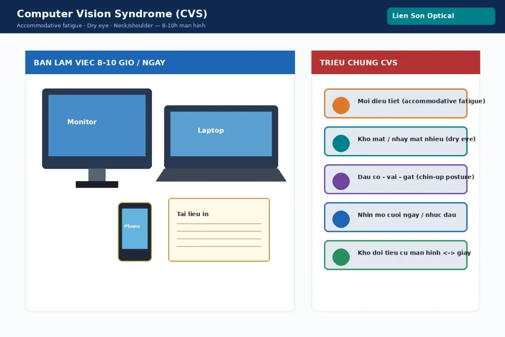 CVS: mỏi điều tiết, khô mắt, đau cổ vai khi làm việc 8–10 giờ trước màn hình